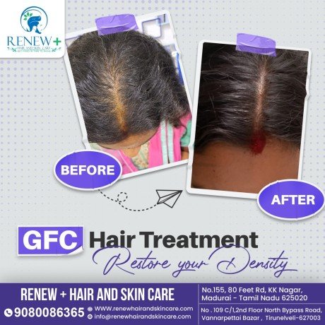 solution-for-hair-fall-problem-get-ready-trendy-hair-big-2