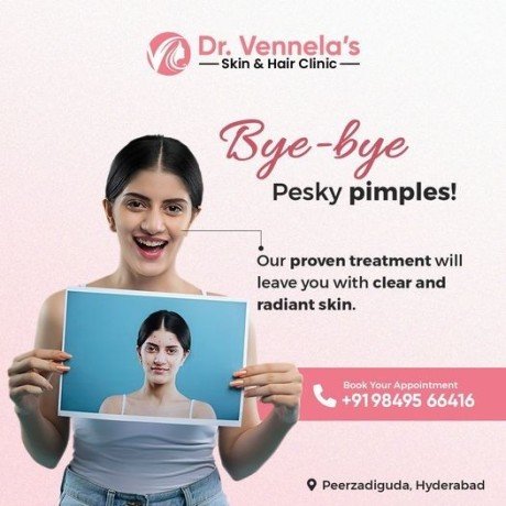 best-skin-specialist-in-peerzadiguda-hair-loss-treatment-in-peerzadiguda-big-3