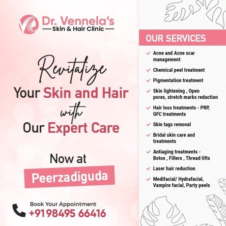 best-skin-specialist-in-peerzadiguda-hair-loss-treatment-in-peerzadiguda-big-1