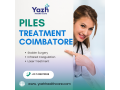 piles-treatment-coimbatore-yazh-healthcare-small-0