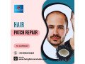 hair-patch-repair-replacement-center-in-bangalore-hair-glimmer-small-0