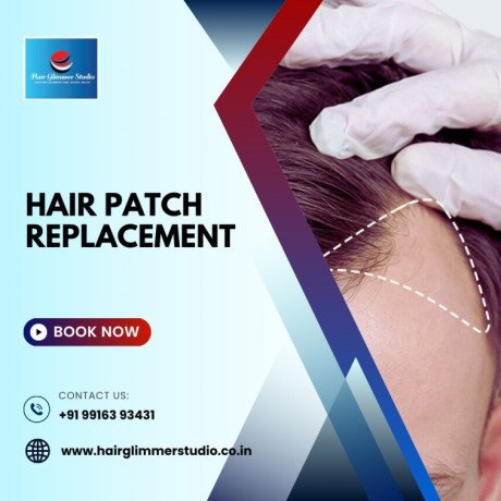 hair-patch-repair-replacement-center-in-bangalore-hair-glimmer-big-2